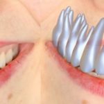 Odontología: adiós a los moldes de yeso