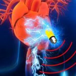 Cargador de marcapasos que trabaja con iones de la sangre