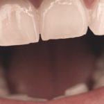 Salud dental: Ecuador la mejor; Guatemala la peor