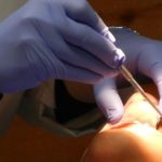 Crean molécula que impide las caries dentales