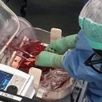 Transportando, en caliente, órganos para transplantes