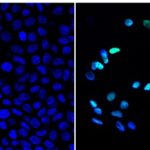 Nuevo método para matar de hambre, las células cancerosas