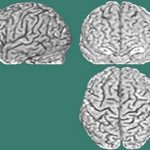 Cada persona tiene un cerebro.. único
