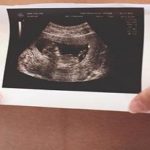 El sexo del bebé, influye en el embarazo de la madre