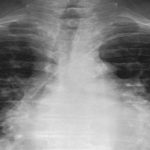 350 mil radiografías para la investigación médica