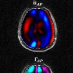 El cerebro infantil..frente a las matemáticas