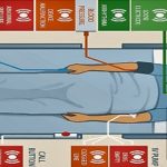 Enfermeras luchando contra el zumbido.. de las alarmas de cuidados intensivos