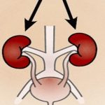 Arman la arquitectura genética de la enfermedad renal