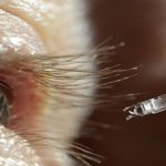 Inventan dispositivo..para colocar medicinas en la retina del ojo