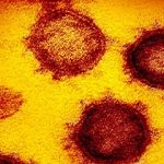 CORONAVIRUS: Hoy, 158 casos, 2 muertes, en Latinoamérica