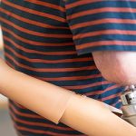 Prueban con éxito.. prótesis autónomas sensibles al tacto