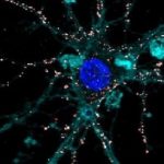 En Italia, inventan primera prótesis líquida.. para reparar la retina