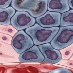 La aspirina puede acelerar el cáncer.. en adultos
