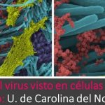 Covid-19 : Logran imágenes del virus.. en altísima resolución