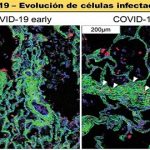 Covid-19: Nueva técnica para analizar células del pulmón