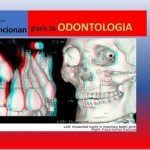 Comunes gafas en 3D.. sirven a la enseñanza de la odontología