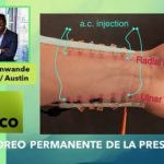 Dispositivo para el monitoreo continuo.. de la presión arterial