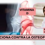 Descartan que la Vitamina D .. ayude contra el riesgo de fracturas