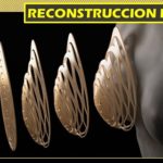 Nueva técnica .. para la reconstrucción de los senos