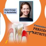 Enfermedad de las encías .. vinculada con la artritis