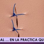 Descubren el nudo más seguro.. para la sutura de las heridas