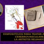 Nuevas opciones para tratar daños por accidentes cerebrovasculares: U. OHSU- Oregón